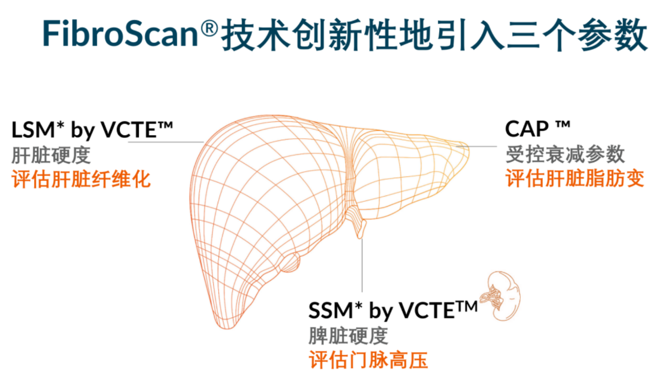 喜訊！FDA擴大了FibroScan?在肝臟綜合管理中的應用范圍